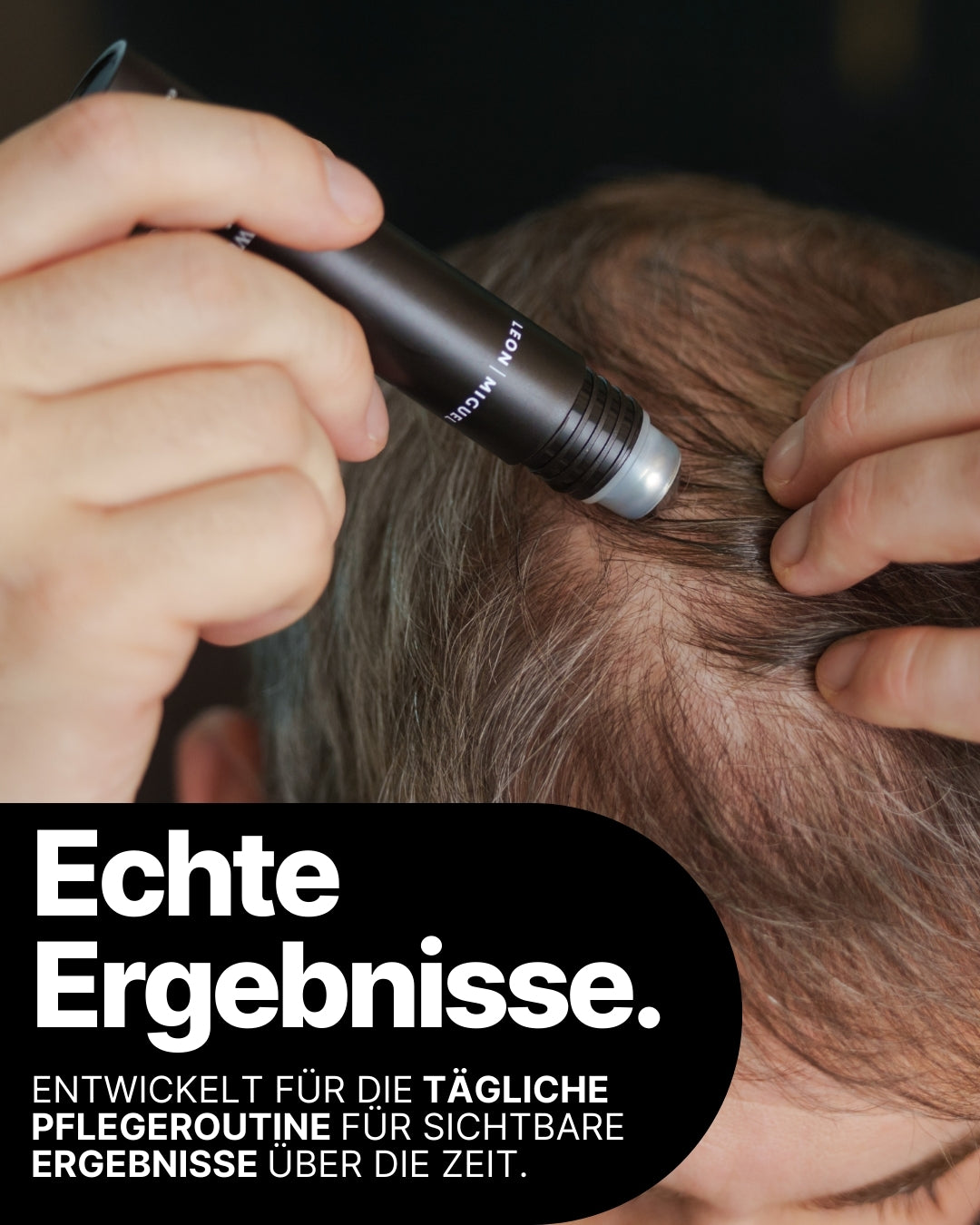 Hair Growth Activator Haarserum für dichteres kräftigeres Haar und sichtbar mehr Volumen bei Frauen und Männern